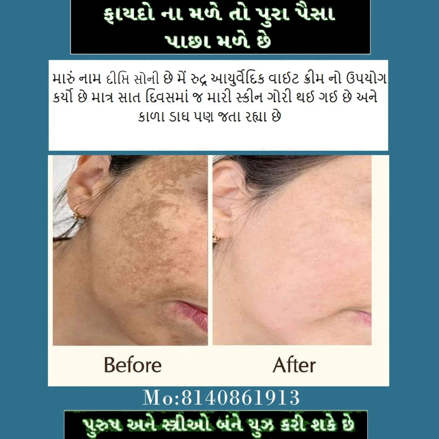 Before & After result