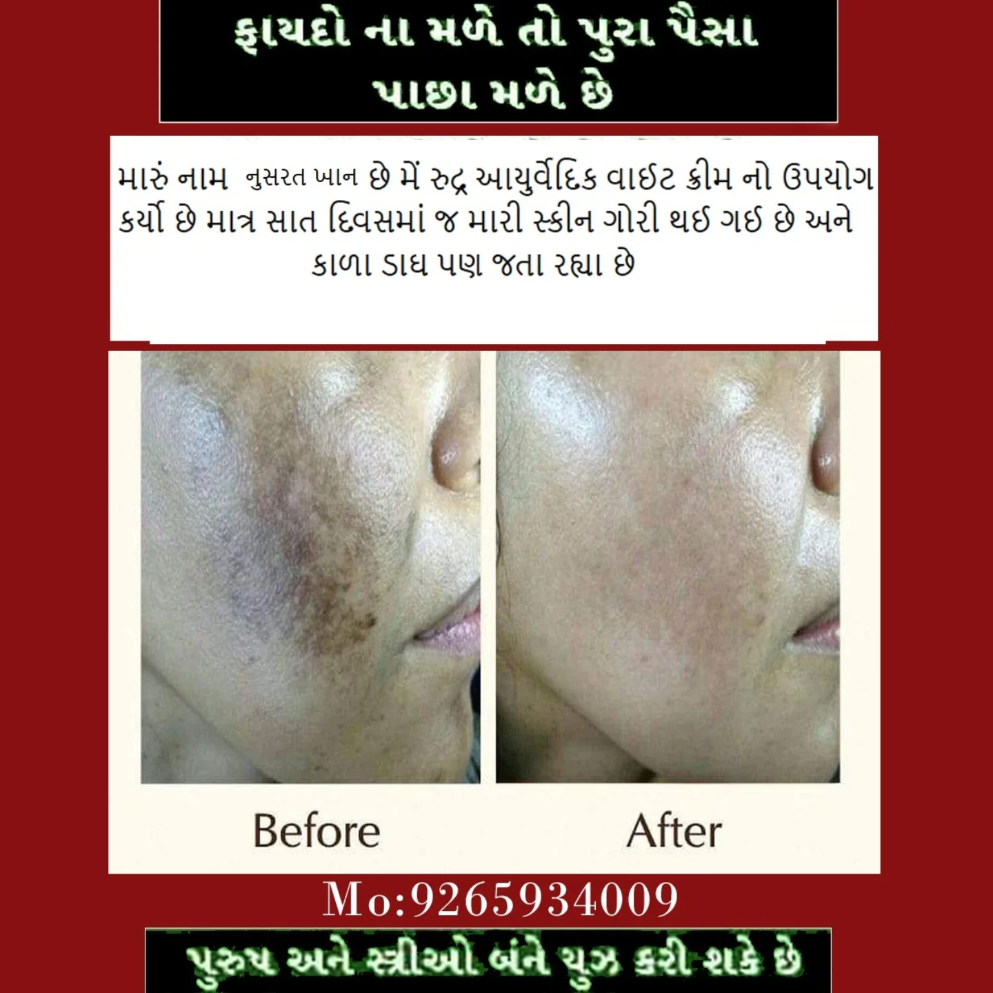 Before & After result