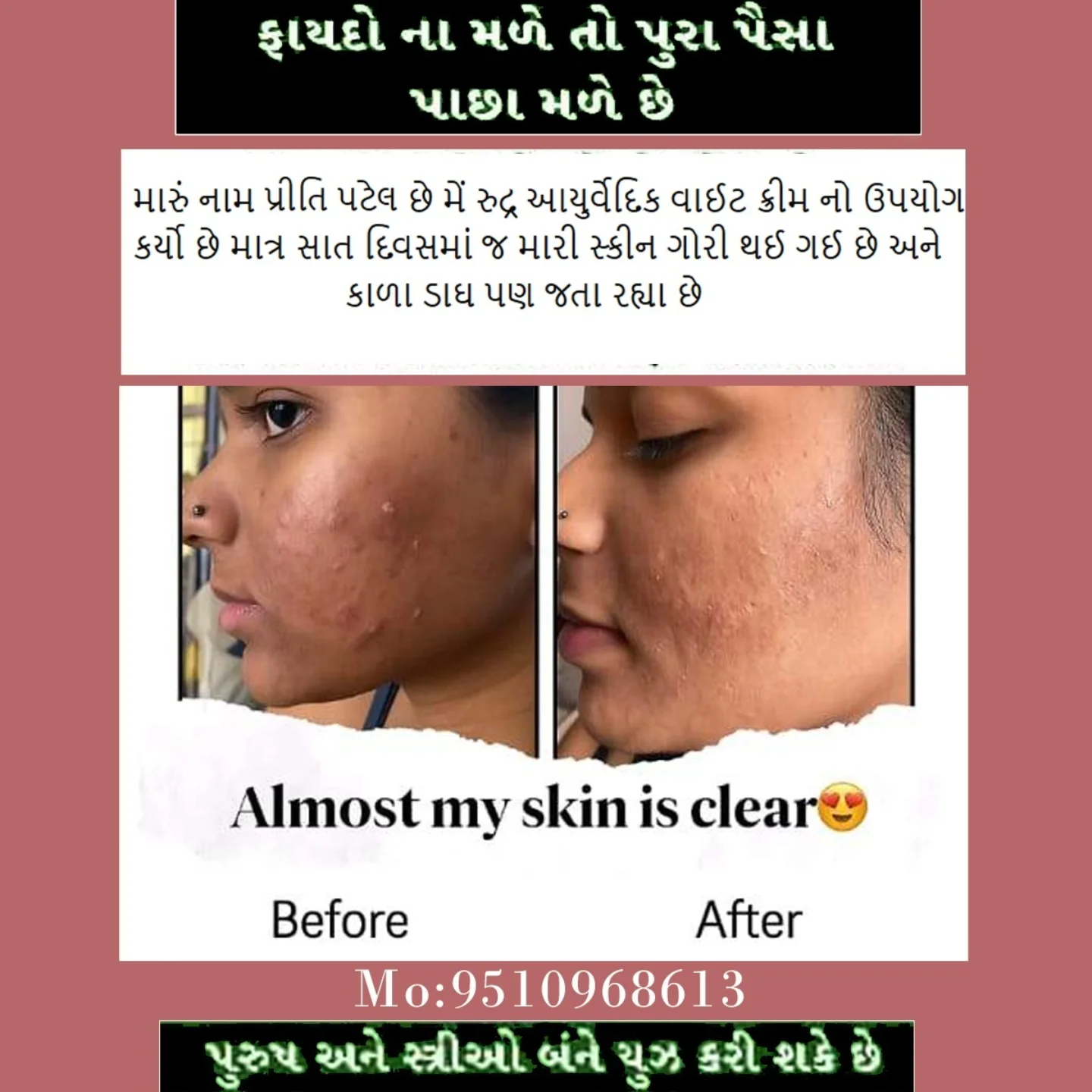 Before & After result